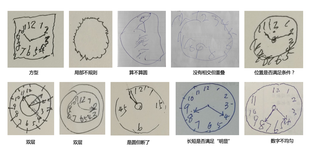 国际医学杂志《柳叶刀》研究表明阿尔茨海默病患者高达983万人 首个AI筛查小程序上线 国际医学杂志《柳叶刀》研究表明阿尔茨海默病患者高达983万人 首个AI筛查小程序上线